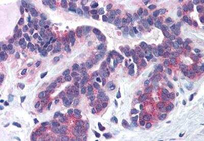 Immunohistochemistry-Paraffin: SNX16 Antibody [NB100-1211]