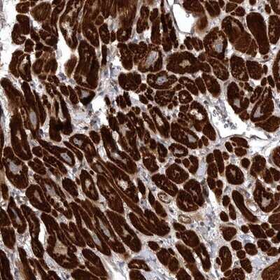 Immunohistochemistry-Paraffin: SNX16 Antibody [NBP1-85974]