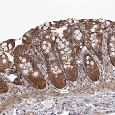 Immunohistochemistry-Paraffin: SNX16 Antibody [NBP1-85975]