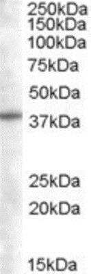 Western Blot: SNX16 Antibody [NB100-1211]