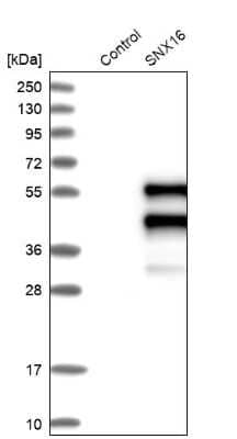 Western Blot: SNX16 Antibody [NBP1-85972]