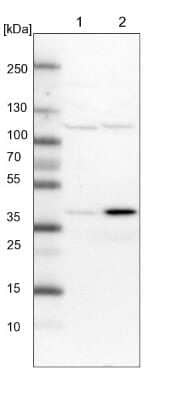 Western Blot: SNX16 Antibody [NBP1-85975]