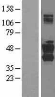 Western Blot: SNX16 Overexpression Lysate [NBL1-16307]