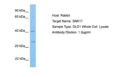 Western Blot: SNX17 Antibody [NBP2-88326]