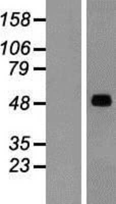 Western Blot: SNX17 Overexpression Lysate [NBP2-07282]