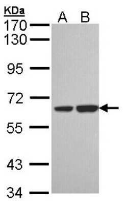 Western Blot: SNX18 Antibody [NBP1-33089]