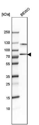 Western Blot: SNX18 Antibody [NBP1-82361]