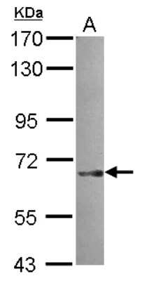 Western Blot: SNX18 Antibody [NBP2-20443]