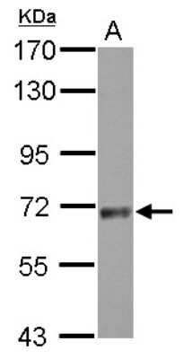 Western Blot: SNX18 Antibody [NBP2-20443]