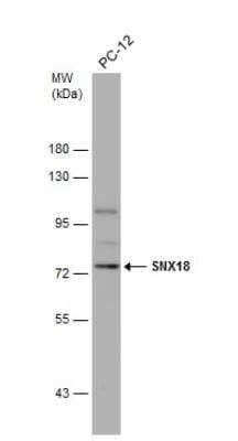 Western Blot: SNX18 Antibody [NBP2-20443]