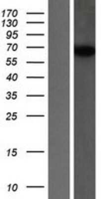 Western Blot: SNX18 Overexpression Lysate [NBL1-16309]