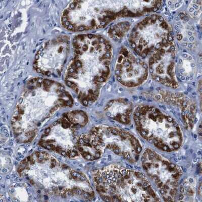 Immunohistochemistry-Paraffin: SNX19 Antibody [NBP1-84491]