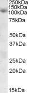 Western Blot: SNX19 Antibody [NBP1-20976]