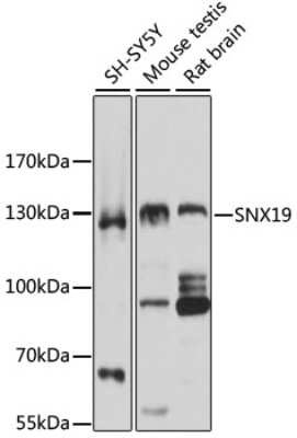 Western Blot: SNX19 AntibodyAzide and BSA Free [NBP2-93361]