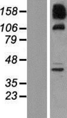 Western Blot: SNX19 Overexpression Lysate [NBP2-07278]