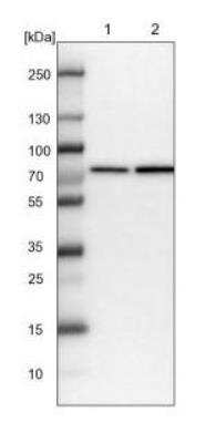 Western Blot: SNX2 Antibody [NBP1-89485]