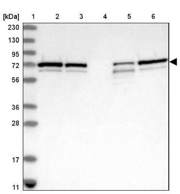 Western Blot: SNX2 Antibody [NBP1-89485]