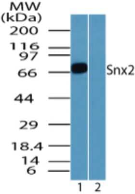 Western Blot: SNX2 Antibody [NBP2-24513]