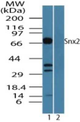 Western Blot: SNX2 Antibody [NBP2-24514]