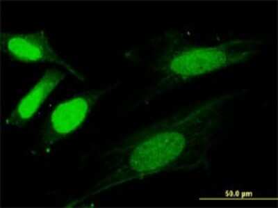 Immunocytochemistry/ Immunofluorescence: SNX20 Antibody (4E9) [H00124460-M05]