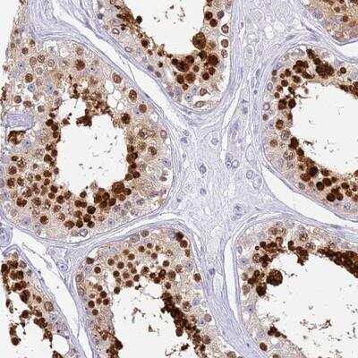 Immunohistochemistry-Paraffin: SNX20 Antibody [NBP1-92418]