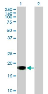 Western Blot: SNX20 Antibody [H00124460-B01P]