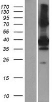 Western Blot: SNX20 Overexpression Lysate [NBP2-04818]