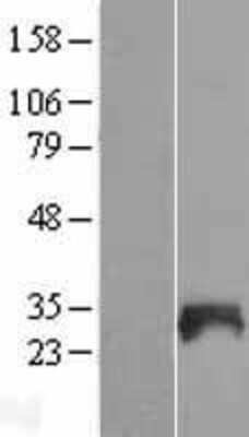 Western Blot: SNX21 Overexpression Lysate [NBL1-16311]