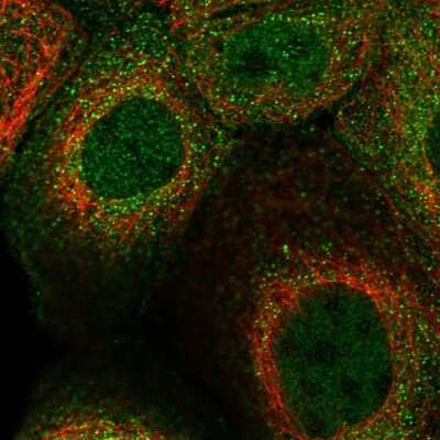 Immunocytochemistry/ Immunofluorescence: SNX22 Antibody [NBP1-82244]