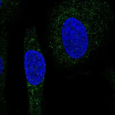 Immunocytochemistry/ Immunofluorescence: SNX24 Antibody [NBP2-56620]