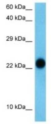 Western Blot: SNX24 Antibody [NBP3-09968]