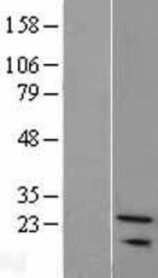 Western Blot: SNX24 Overexpression Lysate [NBL1-16312]