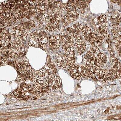 Immunohistochemistry: SNX26 Antibody [NBP1-92421]