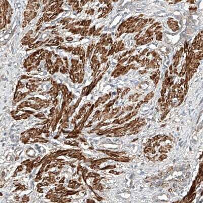 Immunohistochemistry-Paraffin: SNX26 Antibody [NBP1-92420]