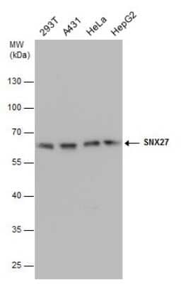 Western Blot: SNX27 Antibody (1C6) [NBP3-13510]