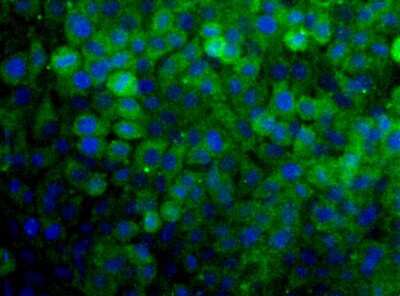 Immunocytochemistry/ Immunofluorescence: SNX27 Antibody - BSA Free [NBP1-45282]