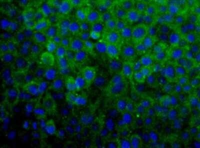 Immunocytochemistry/ Immunofluorescence: SNX27 Antibody - BSA Free [NBP1-45283]