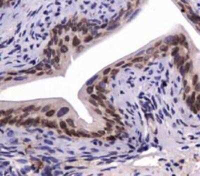 Immunohistochemistry: SNX27 Antibody - BSA Free [NBP1-45282]
