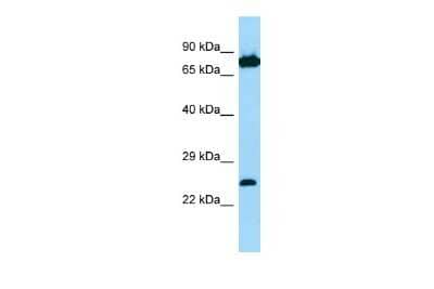 Western Blot: SNX27 Antibody [NBP2-86817]