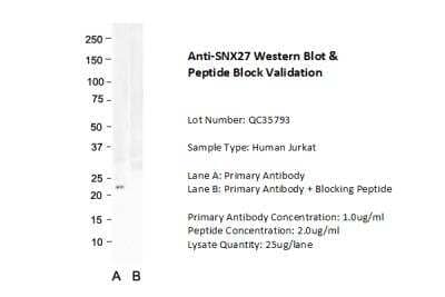 Western Blot: SNX27 Antibody [NBP2-86817]