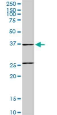 Western Blot: SNX29 Antibody (6D6) [H00084127-M02]