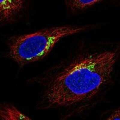 Immunocytochemistry/ Immunofluorescence: SNX29 Antibody [NBP3-17935]