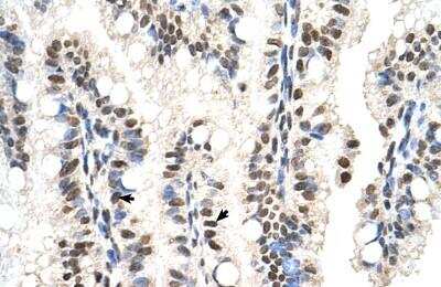 Immunohistochemistry-Paraffin: SNX29 Antibody [NBP1-79261]