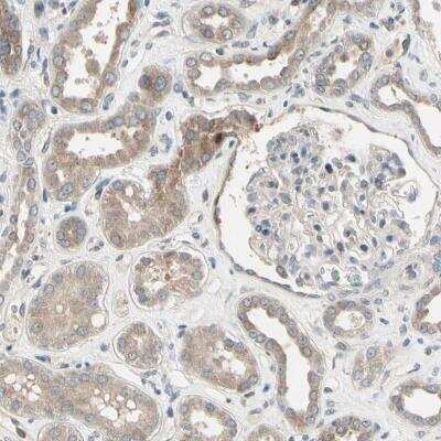 Immunohistochemistry-Paraffin: SNX29 Antibody [NBP1-82304]