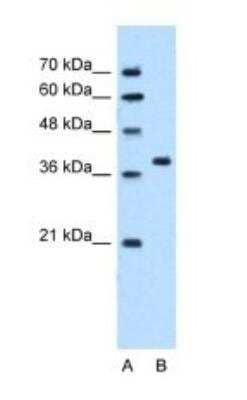 Western Blot: SNX29 Antibody [NBP1-79261]