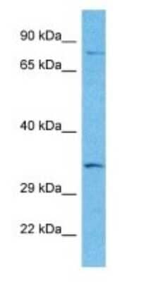 Western Blot: SNX29 Antibody [NBP3-09243]