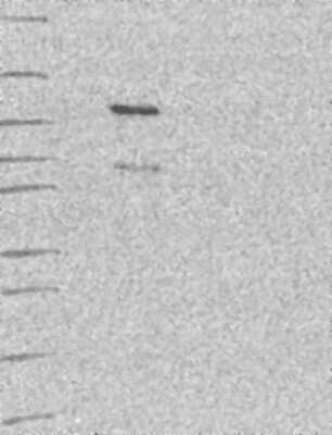 Western Blot: SNX29 Antibody [NBP3-17935]