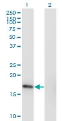 Western Blot: SNX3 Antibody (3A9) [H00008724-M10]