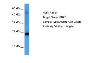 Western Blot: SNX3 Antibody [NBP2-86821]