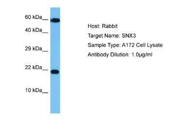 Western Blot: SNX3 Antibody [NBP2-86824]